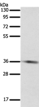 SULT1E1 Antibody in Western Blot (WB)