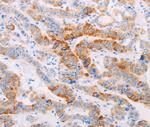 MAP4K3 Polyclonal Antibody
