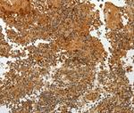 TFF2 Polyclonal Antibody