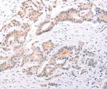TRAF3IP1 Polyclonal Antibody