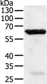 TRAF5 Antibody in Western Blot (WB)