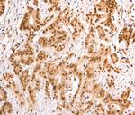 TAX1BP1 Antibody in Immunohistochemistry (Paraffin) (IHC (P))