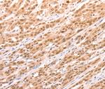 TAX1BP1 Polyclonal Antibody