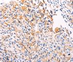 PGBD1 Polyclonal Antibody