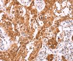 NCEH1 Polyclonal Antibody