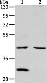 NCEH1 Antibody in Western Blot (WB)