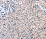 AADACL2 Polyclonal Antibody