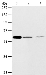 ABCE1 Polyclonal Antibody