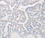 ABHD1 Polyclonal Antibody