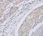 ABLIM1 Polyclonal Antibody