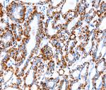 ACAA2 Polyclonal Antibody
