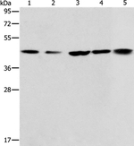 ACAA2 Antibody in Western Blot (WB)