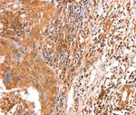 ACAD9 Polyclonal Antibody