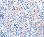 ACAD11 Polyclonal Antibody