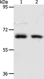 ACOT11 Antibody in Western Blot (WB)