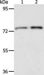 ACOX2 Antibody in Western Blot (WB)