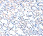 ACSM5 Polyclonal Antibody