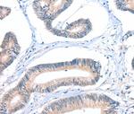 FHL5 Polyclonal Antibody