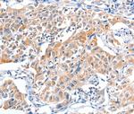 FHL5 Antibody in Immunohistochemistry (Paraffin) (IHC (P))