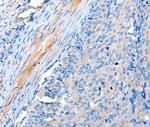 ACTRT1 Polyclonal Antibody