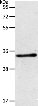 ACY3 Antibody in Western Blot (WB)