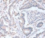 ACOT9 Polyclonal Antibody