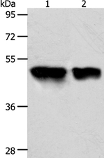 ACOT9 Antibody in Western Blot (WB)