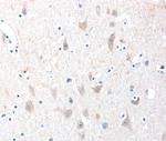 ADAM20 Polyclonal Antibody
