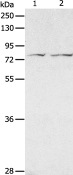 ADAM20 Antibody in Western Blot (WB)