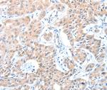 ADAM21 Polyclonal Antibody