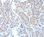 ADAMTSL1 Polyclonal Antibody