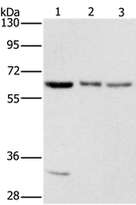 Aladin Antibody in Western Blot (WB)