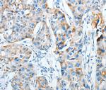 AGA Polyclonal Antibody