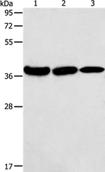 AGA Antibody in Western Blot (WB)