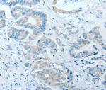 AKAP7 Polyclonal Antibody