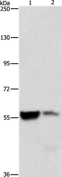 ALDH8A1 Antibody in Western Blot (WB)