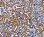 ALG12 Polyclonal Antibody