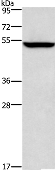 ALG12 Antibody in Western Blot (WB)