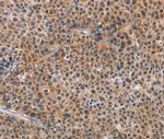 AGPS Antibody in Immunohistochemistry (Paraffin) (IHC (P))