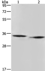 AMDHD2 Antibody in Western Blot (WB)
