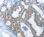 ANKMY1 Antibody in Immunohistochemistry (Paraffin) (IHC (P))