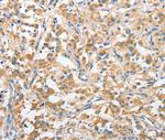 ANKMY2 Antibody in Immunohistochemistry (Paraffin) (IHC (P))
