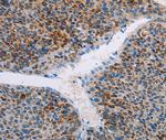 APOBEC4 Polyclonal Antibody