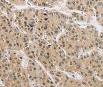 AMZ2 Antibody in Immunohistochemistry (Paraffin) (IHC (P))