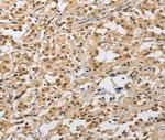 AMZ2 Polyclonal Antibody