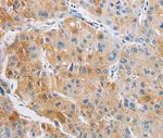 ARHGAP5 Antibody in Immunohistochemistry (Paraffin) (IHC (P))