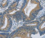 ARHGEF3 Antibody in Immunohistochemistry (Paraffin) (IHC (P))
