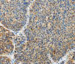 ARHGEF3 Antibody in Immunohistochemistry (Paraffin) (IHC (P))
