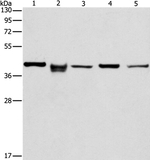 IDH3B Antibody in Western Blot (WB)