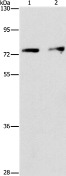 INTS10 Antibody in Western Blot (WB)